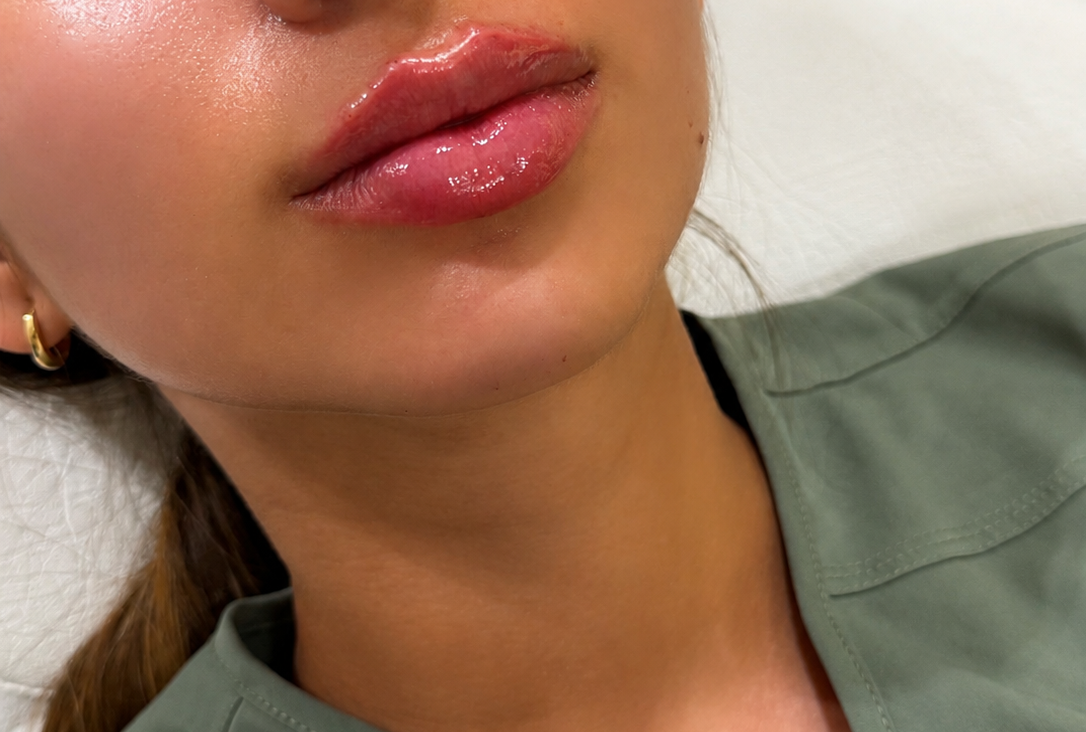 Labios naturales y definidos